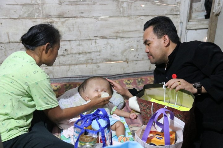 Wakil Bupati Ajak Opd Terkait Bantu Keluarga Bayi Hydrocephalus