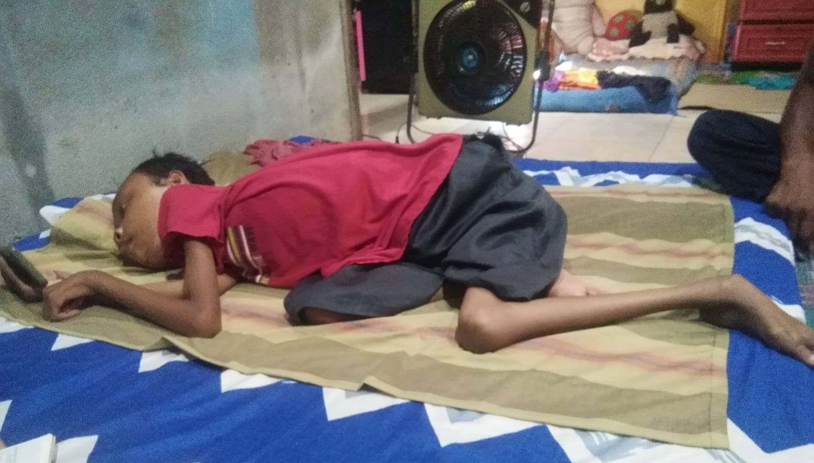 Warga Sidodadi Asri Menderita Lumpuh Layu Sejak Usia 1 Tahun